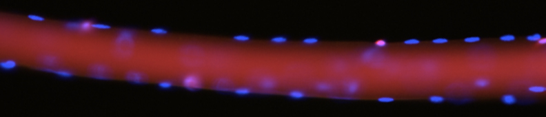 Muscle stem cells on myofibers